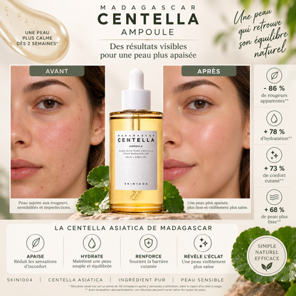 Ampoule Apaisante à la Centella de Madagascar – SKIN1004 100 ml